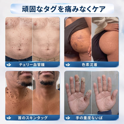 5日で効果を実感 ― Geelemon® 2-in-1 マイクロニードル・ハイドロコロイドパッチ：肌の気になる箇所をケアする、痛みや跡が残らない高品質なパッチです。