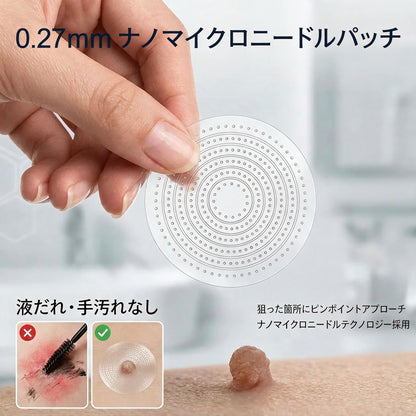 5日で効果を実感 ― Geelemon® 2-in-1 マイクロニードル・ハイドロコロイドパッチ：肌の気になる箇所をケアする、痛みや跡が残らない高品質なパッチです。